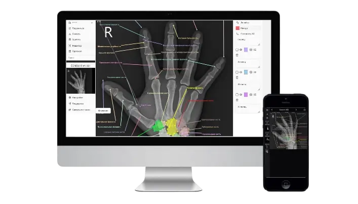 Что такое онлайн DICOM-вьюер и как он меняет работу с медицинскими снимками