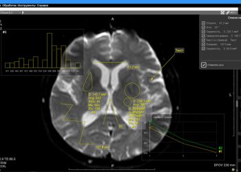 Что такое онлайн DICOM-вьюер и как он меняет работу с медицинскими снимками