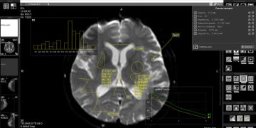 Что такое онлайн DICOM-вьюер и как он меняет работу с медицинскими снимками